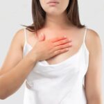 acid reflux transformed