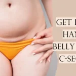 How To Get Rid Of Hanging Belly After C Section 1