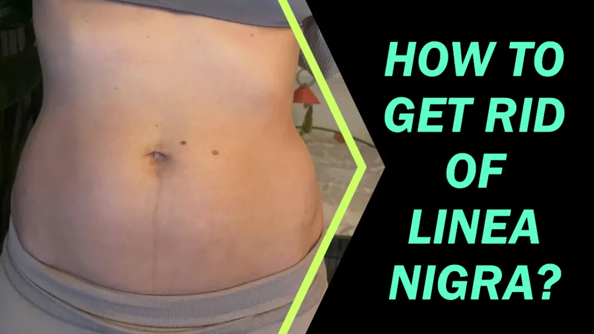 How To Get Rid Of Linea Nigra?