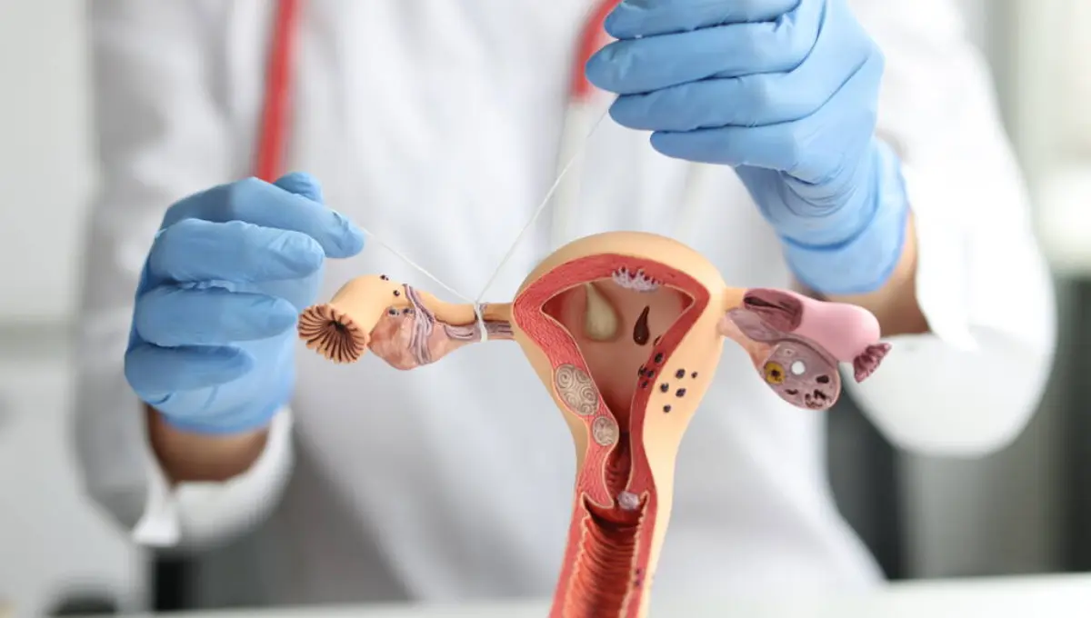 Gynecologist shows how to ligate the fallopian tubes on training model of female reproductive system. Laparoscopic tubal ligation concept 