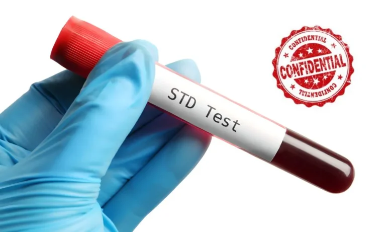 Confidential STD Testing Options And Treatments