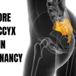 Sore Coccyx in Pregnancy